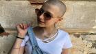 فتاة إيطالية تحارب السرطان بـ"يوتيوب"