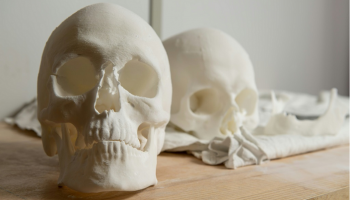  نسخة مطبوعة بالأبعاد الثلاثية لجمجمة