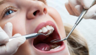 5 نصائح للعناية بأسنان طفلك خلال إجازة نصف العام