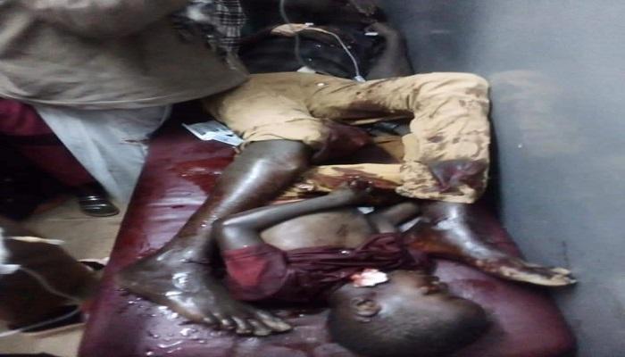 مصاب في انفجار العاصمة السودانية الخرطوم