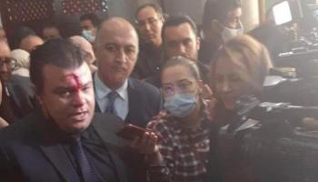 النائب المعتدى عليه 