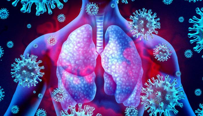 الأجسام المضادة التلقائية ربما تؤدي إلى حالات كوفيد-19 شديدة