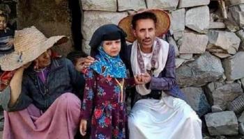 الطفلة اليمنية 