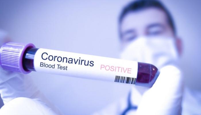 8 حالات إصابة مؤكدة بفيروس كورونا في قطر