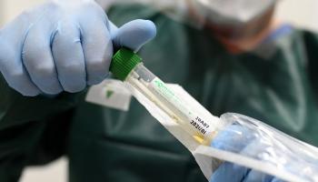 عدد الإصابات بـ"كورونا" في تركيا يرتفع إلى 1236 - أرشيفية