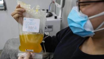  "بلازما النقاهة" علاج محتمل لكورونا 