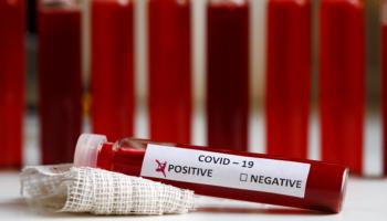 عينة إيجابية بفيروس كورونا المستجد