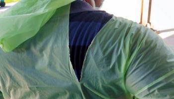 طبيب يضع معطف مطر ممزقا للوقاية