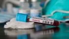 25 إصابة جديدة بفيروس كورونا في سلطنة عمان