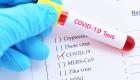 58 إصابة جديدة بفيروس كورونا في المغرب