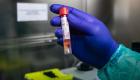 3 وفيات و355 إصابة جديدة بفيروس كورونا في السعودية