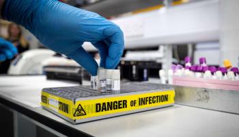 ارتفاع إصابات كورونا في إثيوبيا