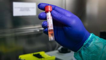 ارتفاع إصابات كورونا في سلطنة عمان