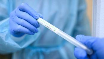 ارتفاع إصابات كورونا في فلسطين