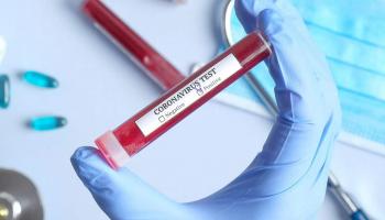 ارتفاع إصابات كورونا في المغرب