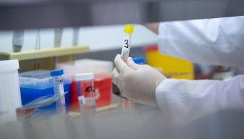 ارتفاع إصابات كورونا في لبنان