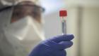 86 إصابة جديدة بفيروس كورونا في سلطنة عمان