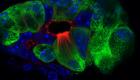 اكتشاف "خلايا خيطية" تقي من التهاب البنكرياس 