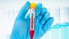 سلطنة عمان تسجل 115 إصابة جديدة بفيروس كورونا  