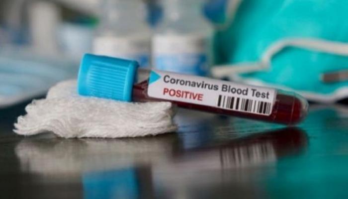 5 إصابات جديدة بفيروس كورونا في إثيوبيا