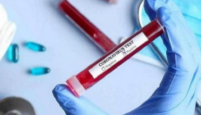 إثيوبيا تسجل إصابتين جديدتين بفيروس كورونا