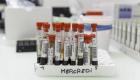 Coronavirus/France: Le tocilizumab s'est avéré efficace contre les cas graves, selon les premiers résultats