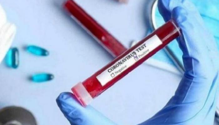 إصابة جديدة بفيروس كورونا في إثيوبيا