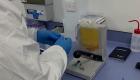 الإمارات تعلن عن مشروع لعلاج مبتكر لفيروس كورونا