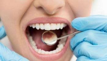 انقطاع الطمث يسبب تسوس الأسنان 