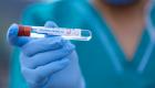 Almanya’da koronavirüs bilançosu: Ölenlerin sayısı 7 bin 549’a yükseldi