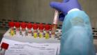 إسرائيل تسجل 19 إصابة جديدة بفيروس كورونا