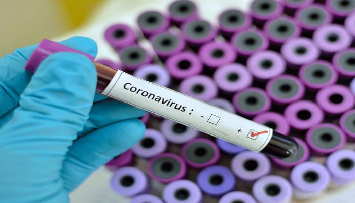 اختبار فيروس كورونا