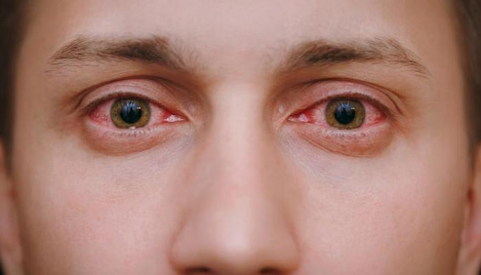 مخاوف بشأن تأثر البصر والعينين بسبب كورونا