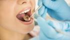 علاج التهاب الأمعاء يبدأ من الأسنان