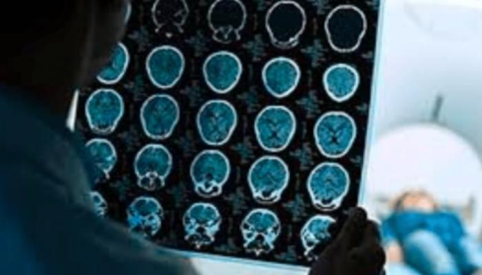 الأطباء قالوا إن اللهجة التي يتحدث بها المريض هي سلافية