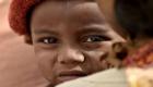 الأمم المتحدة: مليون طفل سوداني يعانون "الجوع الشديد"