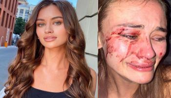 عارضة الأزياء الأوكرانية داريا كيريليوك