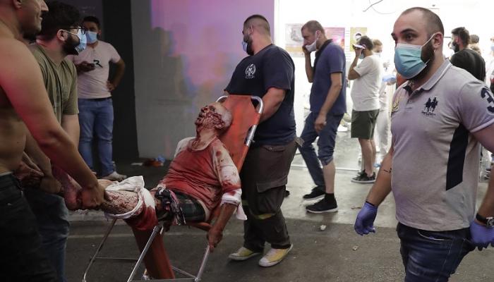 أحد المصابين بانفجار بيروت قبل تقديم الإسعافات اللازمة له