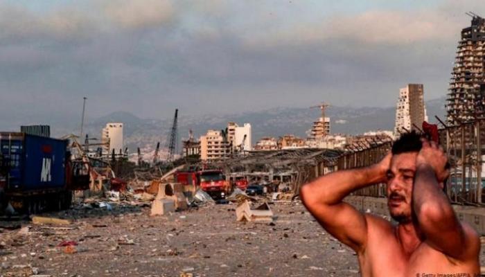 الذهول يرتسم على وجه لبناني جراء الانفجار الذي ضرب المرفأ