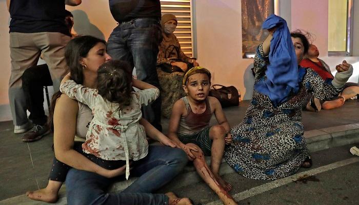 سيدة لبنانية مصابة وأطفالها جراء الانفجار