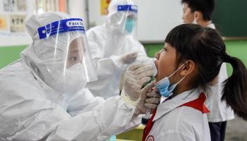 إصابات كورونا حول العالم تصل لـ22 مليونا و863 ألفا و422 إصابة