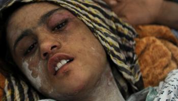 الطفل الذي تم اغتصابه