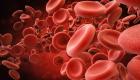 ارتفاع الهيموجلوبين بالدم.. الأسباب والأعراض