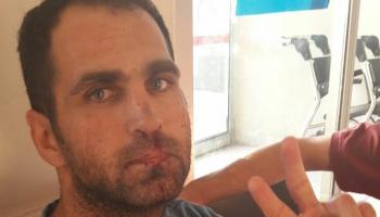 المعتقل بعد الاعتداء عليه