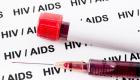 Bilim insanlarını şaşırtan gelişme: HIV pozitif hasta tedavi olmadan iyileşti