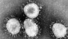 Découverte d'une nouvelle souche du coronavirus "rare et mystérieuse"