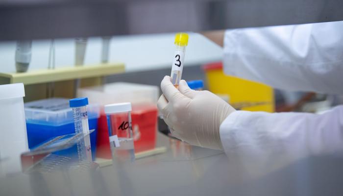 معظم الأدوية فشلت في مواجهة كورونا خلال مرحلة الدراسات الخاصة بها