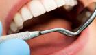 5 نصائح صحية للأسنان في رمضان 2021