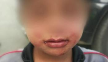 الطفل السوري المعنف من قبل والده