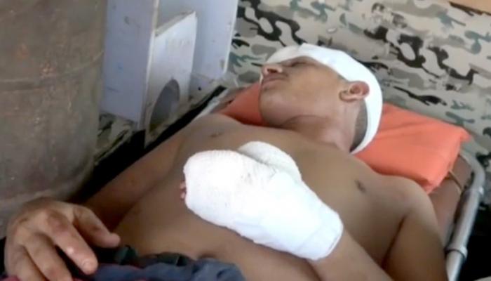 أحد ضحايا هجوم مليشيا الحوثي على سوق شعبي بالحديدة